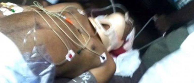 Election Violence Against Opposition Unleashed; A Victim’s Condition Critical