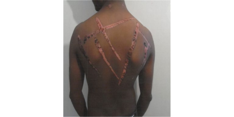﻿  Asylum seeker from Sri Lanka let himself be tortured  to support his bid to stay in Britain