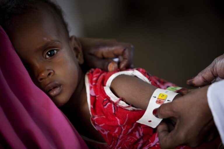 Sri Lanka: Malnutrition rate could be over 20% & Govt. appeal donors to help