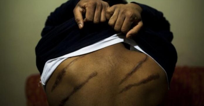 Torture in Sri Lanka
