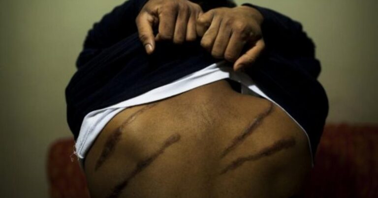 Supreme Court Ruling: Police found guilty of torturing a minor; new directive issued to IGP