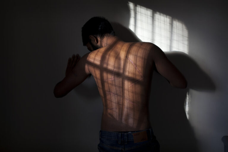 Police Accused of Torturing Youth; Threatened to Insert Cricket Wicket into His Anus – Victim Says Vision in Eye Now Weakened